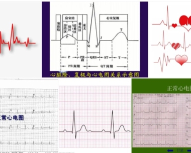 心电图机EMC测试,EMC整改,YY0505-2012报告收费标准